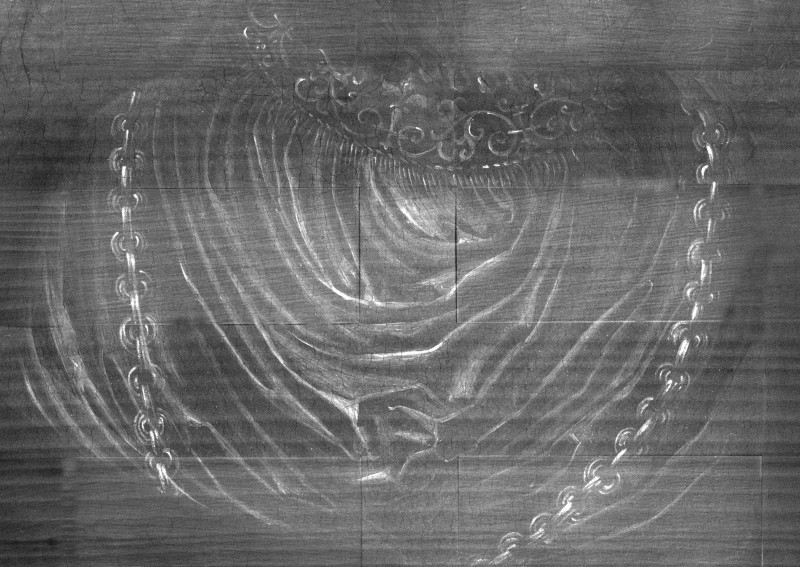 Detalle de la imagen radiográfica