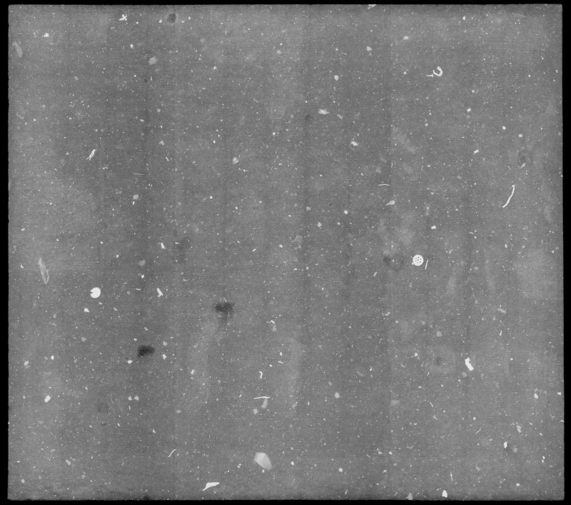 Radiograph image detail