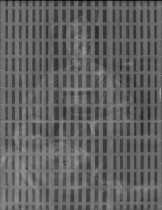 Radiografía