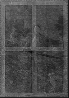 Radiografía