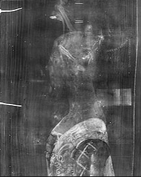 X-ray imaging