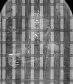 X-ray imaging