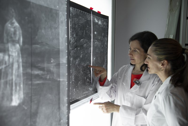 Proceso de estudio de la radiografía en el negatoscopio