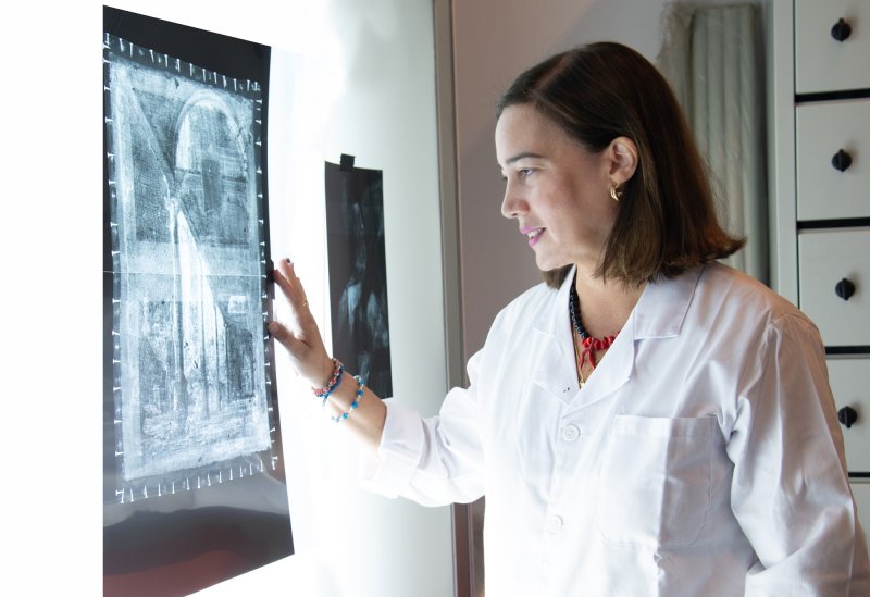 Proceso de estudio de la radiografía en el negatoscopio