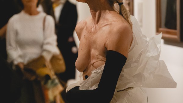 Herida de espejo con tijera, 22 de octubre de 2025